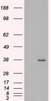 HEK293T cells were transfected with the pCMV6-ENTRY control (Left lane) or pCMV6-ENTRY BFGF (Right lane) cDNA for 48 hrs and lysed