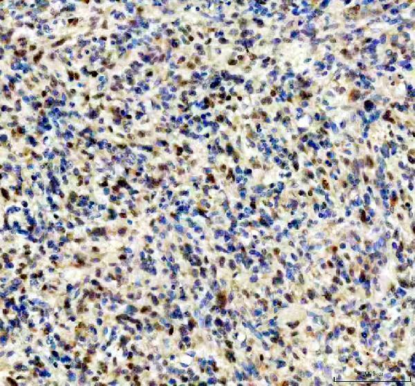 IHC analysis of FGF2 using anti-FGF2 antibody (M00121)