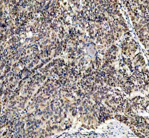 IHC analysis of FGF2 using anti-FGF2 antibody (M00121)