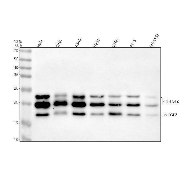 Western blot analysis of FGF2 using anti-FGF2 antibody (M00121)