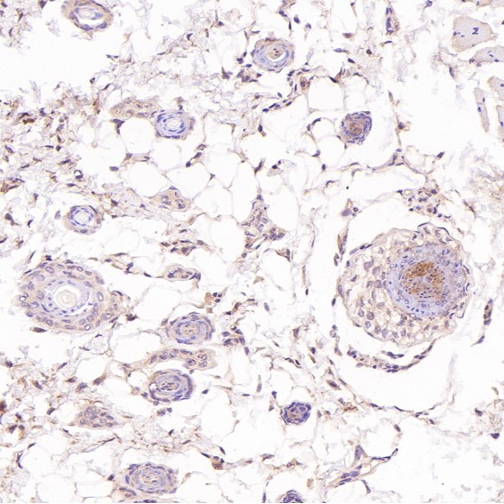 m00122 2 ihc7