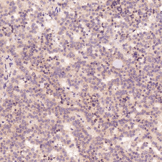 m00122 2 ihc8