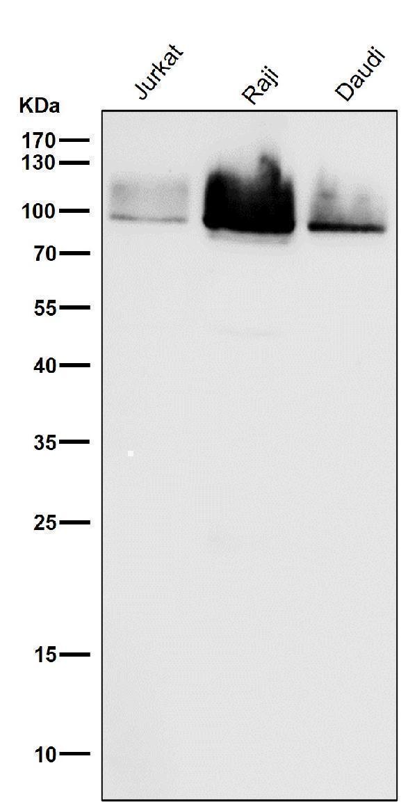 All lanes use the Antibody at 1:1K dilution for 1 hour at room temperature