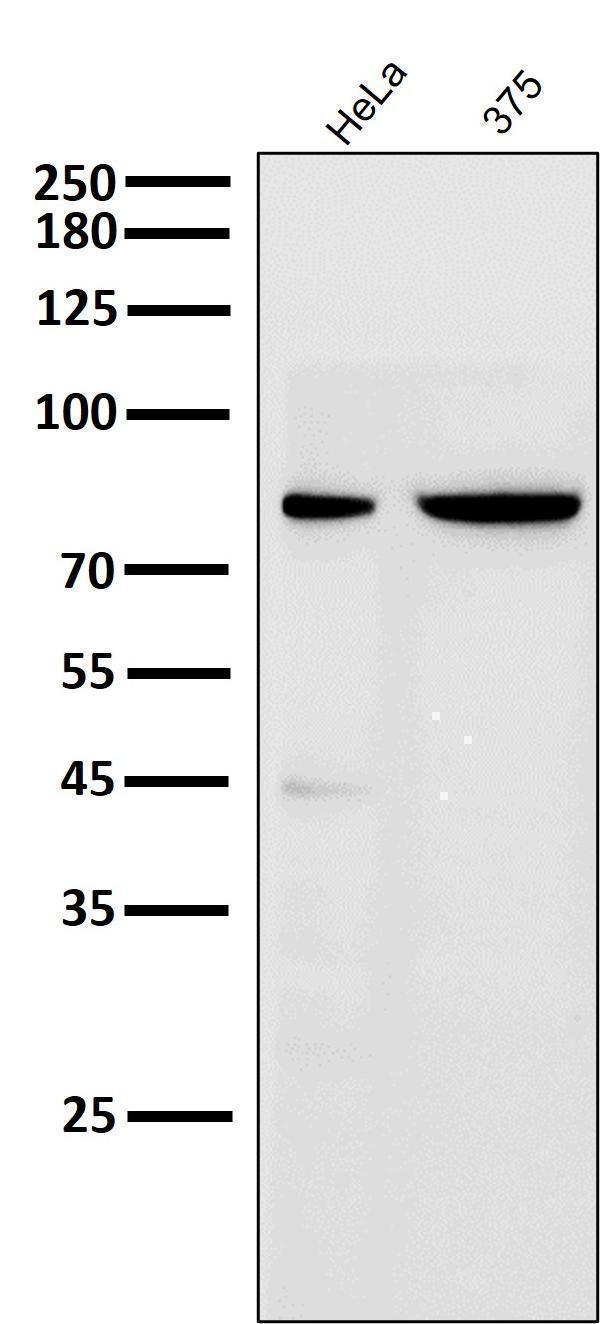 All lanes use the Antibody at 1:6K dilution for 1 hour at room temperature