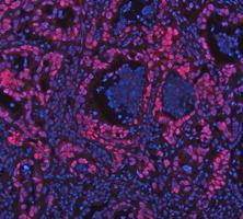 m00122 3 parp1 primary antibodies if testing 12_1