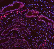 m00122 3 parp1 primary antibodies if testing 13_1