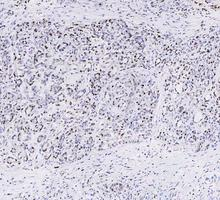 m00122 3 parp1 primary antibodies ihc testing 10_1