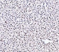 m00122 3 parp1 primary antibodies ihc testing 4_3_1