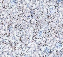 m00122 3 parp1 primary antibodies ihc testing 5_1
