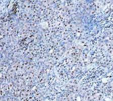 m00122 3 parp1 primary antibodies ihc testing 8_1