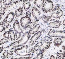 m00122 3 parp1 primary antibodies ihc testing 9_1
