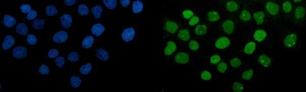 m00122 4 parp primary antibodies if testing 9