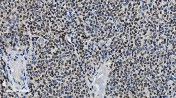 m00122 4 parp primary antibodies ihc testing 7