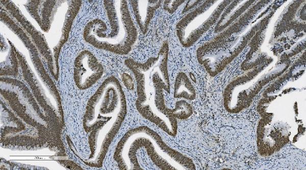 m00122 4 parp primary antibodies ihc testing 8