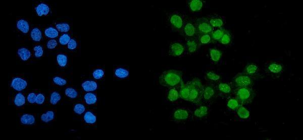 m00122 5 parp primary antibodies if testing 4