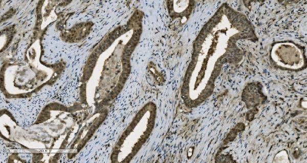  IHC analysis of PARP using anti-PARP antibody (M00122-5)
