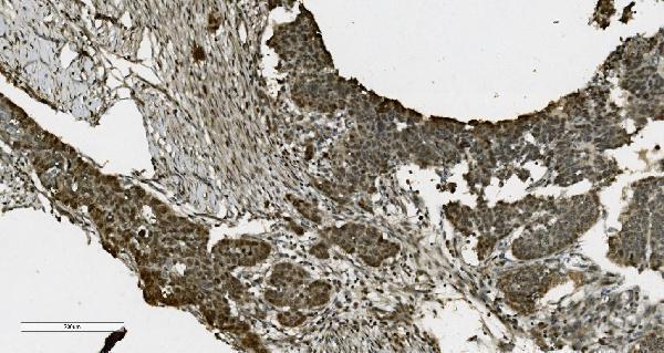  IHC analysis of PARP using anti-PARP antibody (M00122-5)