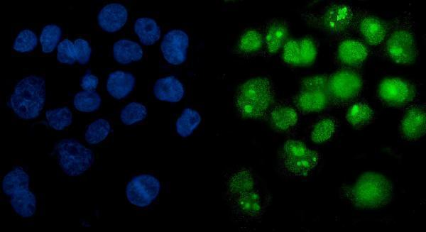 m00122 6 parp primary antibodies if testing 6