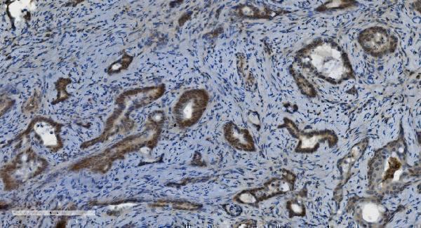 m00122 6 parp primary antibodies ihc testing 2
