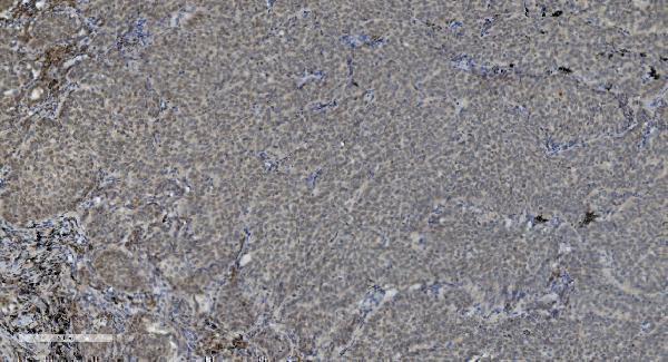 m00122 6 parp primary antibodies ihc testing 3