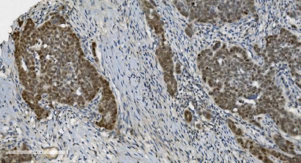 m00122 6 parp primary antibodies ihc testing 4