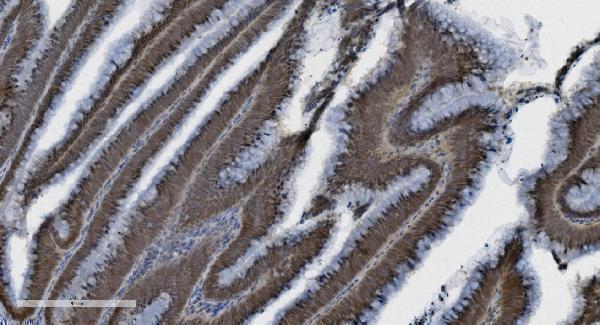 m00122 6 parp primary antibodies ihc testing 5