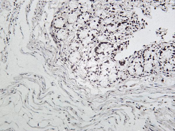 Rat colon tissue was stained with anti-Cleaved PARP1 rabbit Antibody