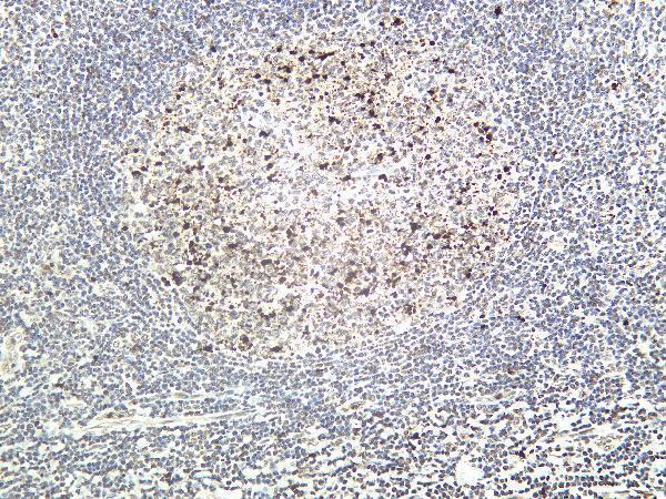 Human tonsil tissue was stained with anti-Cleaved PARP1 rabbit Antibody
