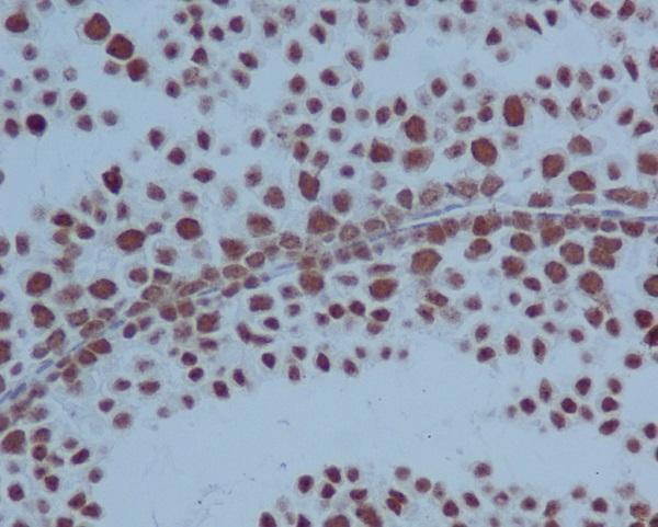 m00122 ihc
