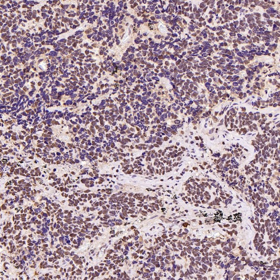 m00122 ihc10