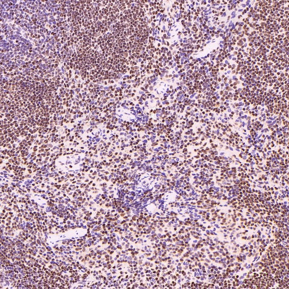 m00122 ihc11