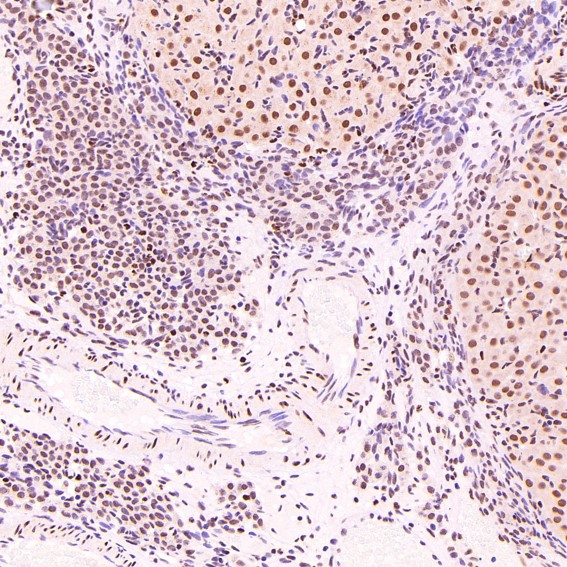 m00122 ihc7