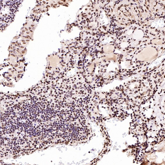 m00122 ihc8