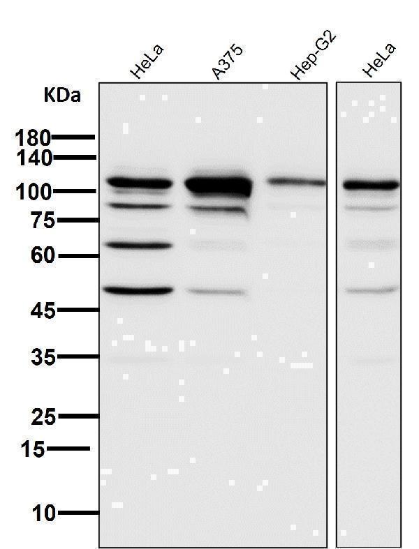 All lanes use the Antibody at 1:6K dilution for 1 hour at room temperature