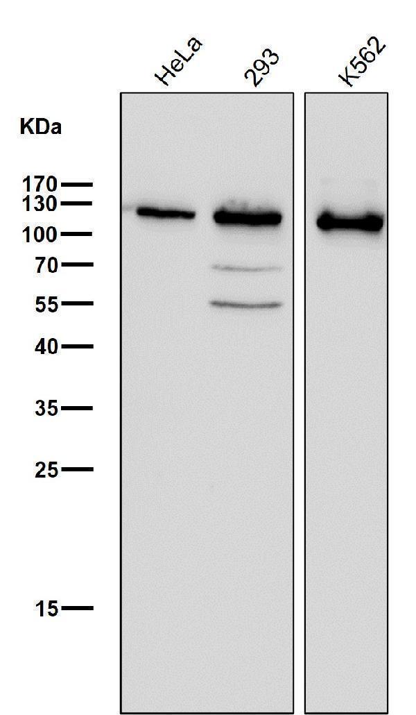 All lanes use the Antibody at 1:1W dilution for 1 hour at room temperature