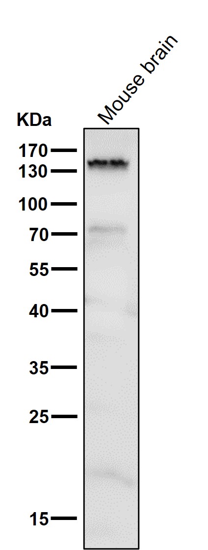  Western blot analysis of Brd4 using anti-Brd4 antibody (M00123)