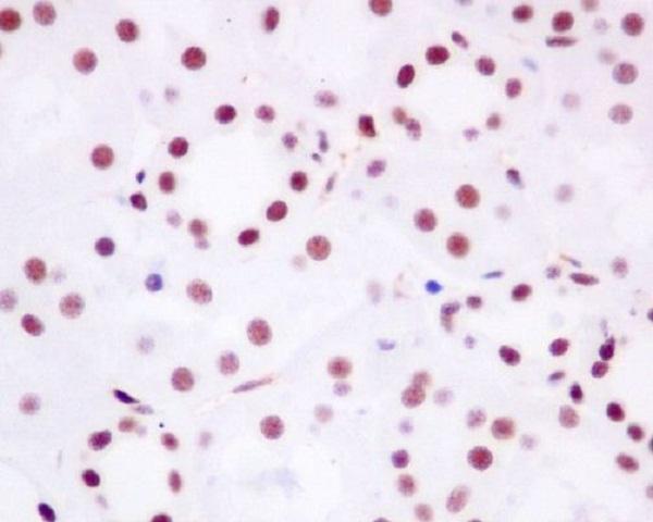 m00123 ihc_1