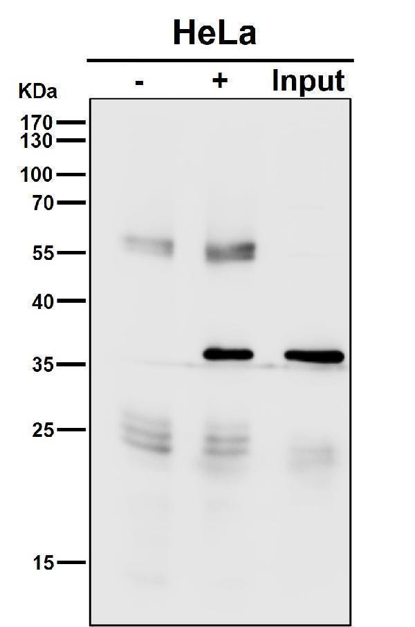 m00125 1 ip7