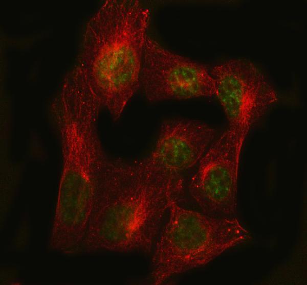  IF analysis of PCNA using anti-PCNA antibody (M00125-1) and anti-Beta Tubulin antibody (M01857-3)