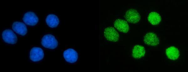 m00125 3 pcna primary antibodies if testing 9
