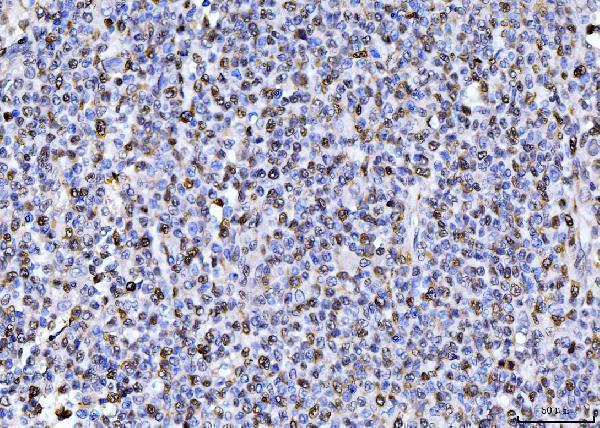  IHC analysis of PCNA using anti-PCNA antibody (M00125-3)