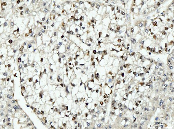 m00125 3 pcna primary antibodies ihc testing 5