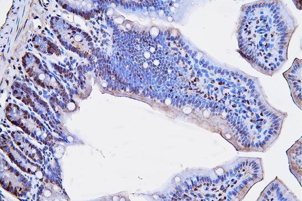 m00125 3 pcna primary antibodies ihc testing 7