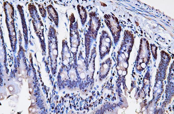m00125 3 pcna primary antibodies ihc testing 8