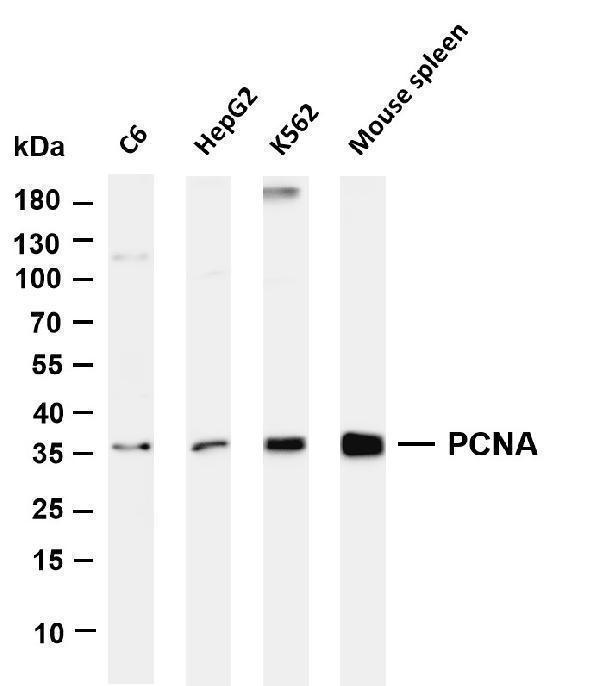 Various whole cell lysates were separated by 4-20% SDS-PAGE, and the membrane was blotted with anti-PCNA antibody