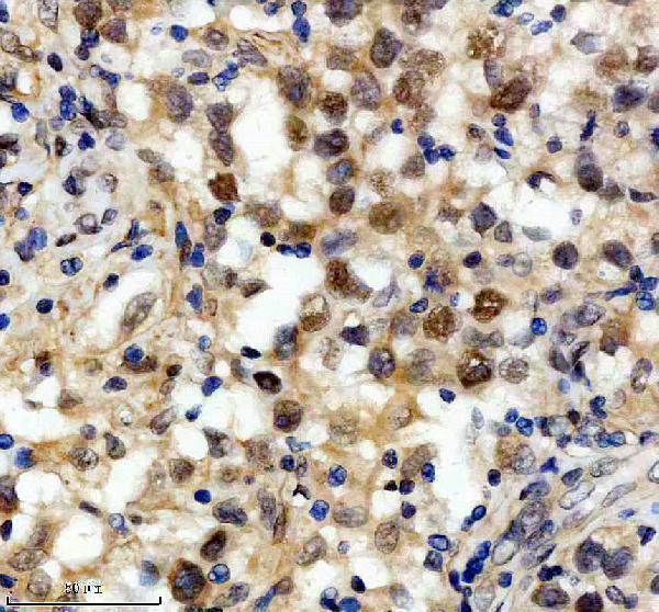 m00126 mlh1 primary antibodies ihc testing 2