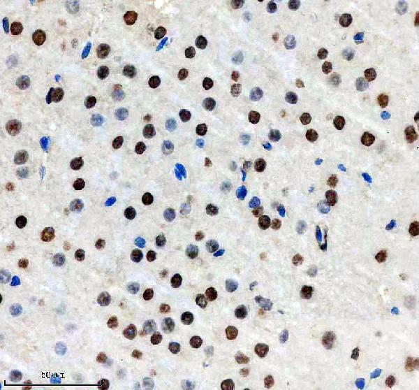 m00126 mlh1 primary antibodies ihc testing 3