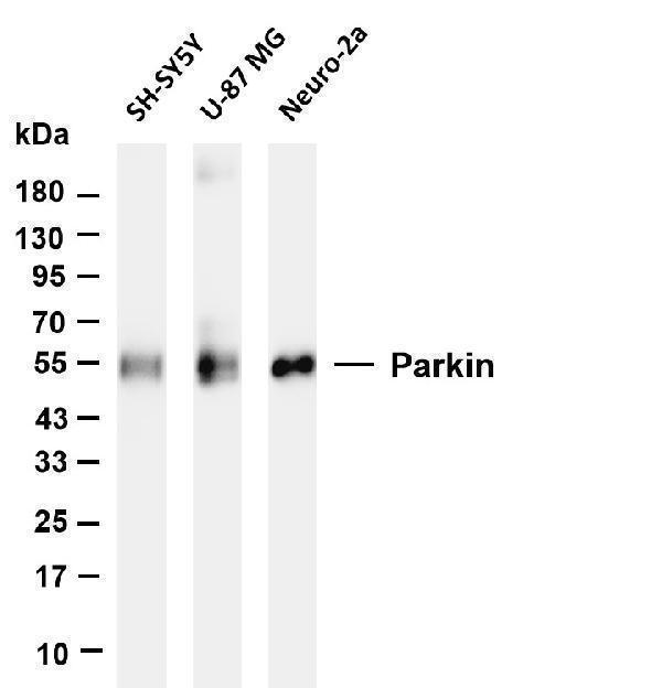 m00127 1 park2 primary antibodies wb testing 1