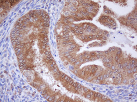 Immunohistochemical staining of paraffin-embedded Human endometrium tissue within the normal limits using anti-IDH1 mouse monoclonal antibody
