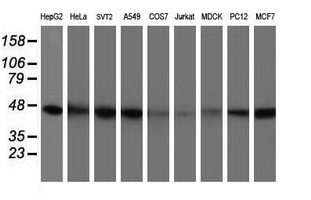 m00129 anti isocitrate dehydrogenase idh1 mouse monoclonal antibody clone id oti1d1 wb testing 3